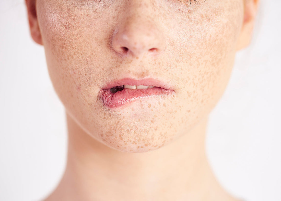 How to get sensitive skin healthy and glowing
